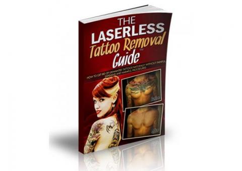 The Laserless Tattoo Removal Guide™
